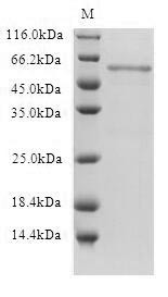 5-Hydroxytryptamine receptor 1B (HTR1B), human, recombinant