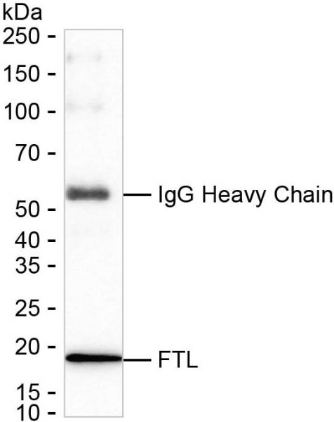 Anti-Ferritin Light Chain