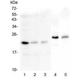 Anti-MOG / Myelin Oligodendrocyte Glycoprotein