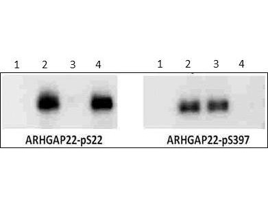 Anti-phospho-ARHGAP22 (Ser22)