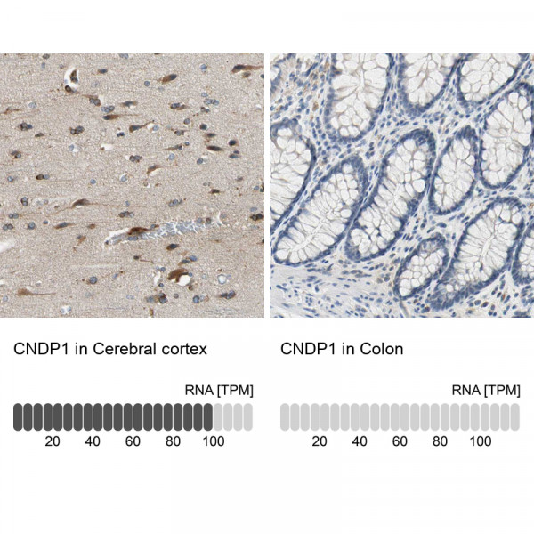 Anti-CNDP1