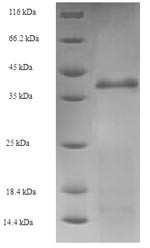 Holliday junction ATP-dependent DNA helicase RuvA (ruvA), Escherichia coli, recombinant