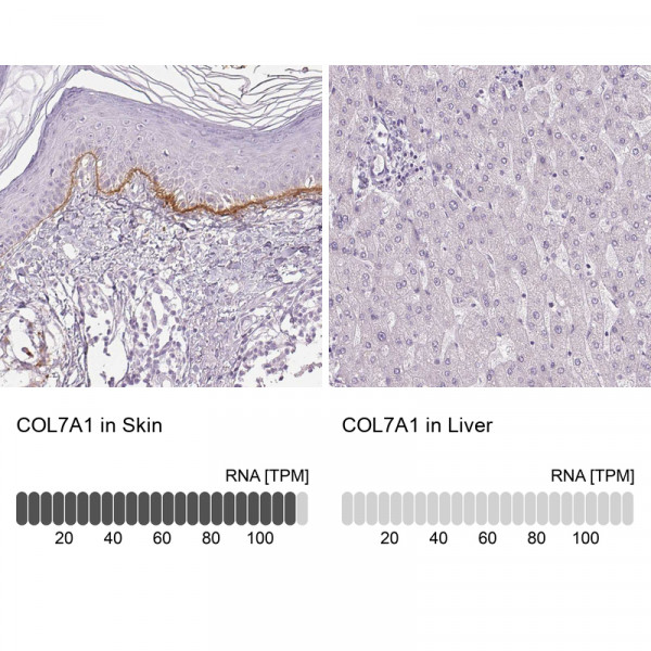 Anti-COL7A1