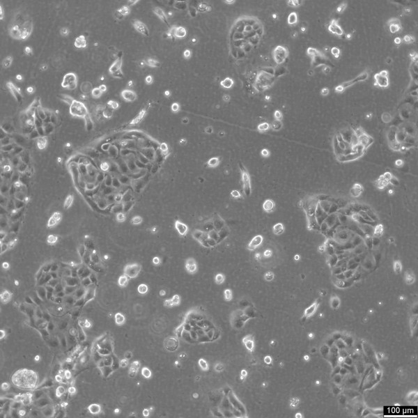 NCI-H2347 Cells