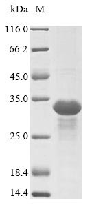 Epstein-Barr nuclear antigen 3 (EBNA3), partial, Epstein-Barr virus, recombinant