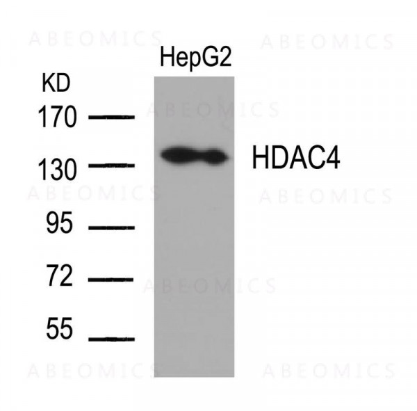 Anti-HDAC4 (Ab-632)