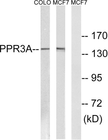 Anti-PPP1R3A