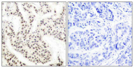 Anti-Phospho-ELK1 (Thr417)