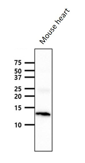 Anti-Cardiac FABP, clone 9F10