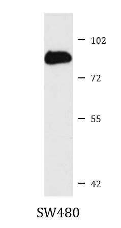 Anti-IL6R alpha