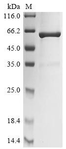 Lysozyme C (LYZ), Biotinylated, chicken, recombinant