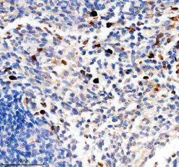 Anti-TCIRG1 / T-cell immune regulator 1