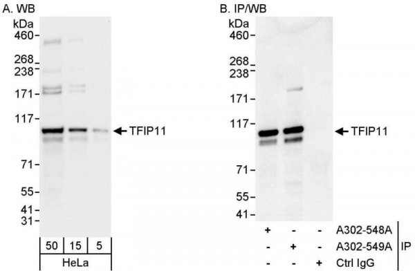 Anti-TFIP11