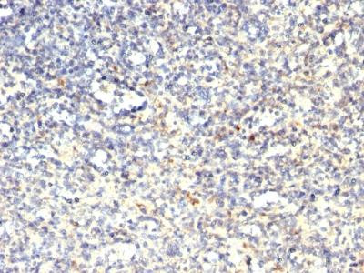 Anti-TRAcP (Tartrate-Resistant Acid Phosphatase) (Hairy Cell Leukemia Marker)(Clone: SPM60