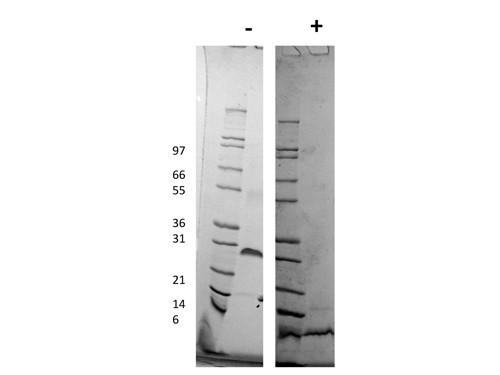 Platelet Derived Growth Factor-BB