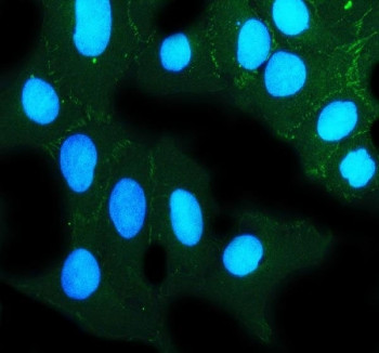 Anti-ZO-2 / Zona Occludens 2