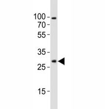 Anti-Olig1