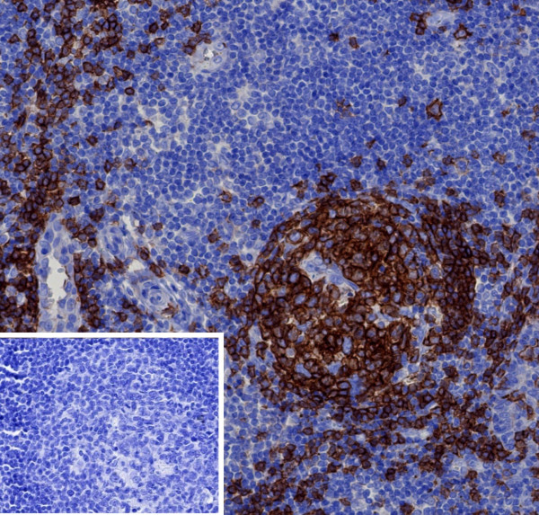 Anti-CD19 (B-Lymphocyte Marker), recombinant antibody, clone CD19/4260R