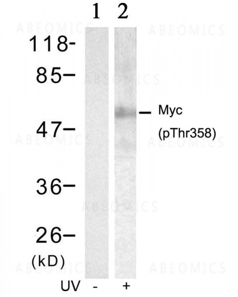 Anti-phospho-Myc (Thr358)