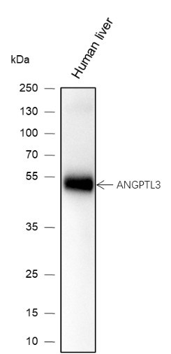 Anti-Recombinant ANGPTL3, clone A133