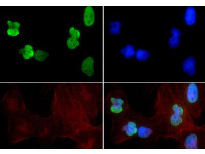 Anti-acetyl-Histone H3 (ac Lys9, ac Lys14)