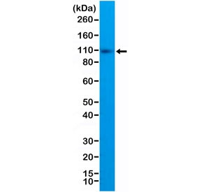 Anti-CD10 / Neprilysin / Cytoplasmic domain, clone RM337