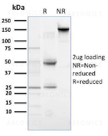 Anti-PLK1 (Marker of Mitosis) Monoclonal Antibody (Clone: AZ44)