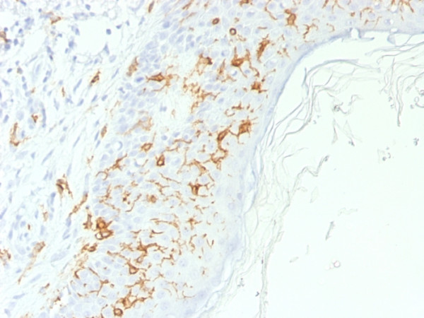 Anti-CD1a / HTA1 (Mature Langerhans Cells Marker)