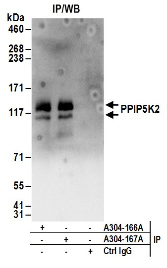 Anti-PPIP5K2