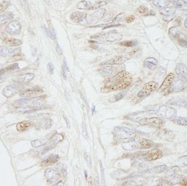 Anti-APC IHC Antibody, affinity purifie (IHC)
