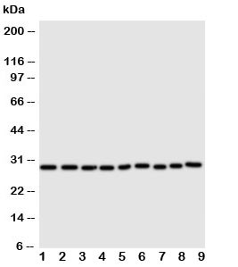 Anti-Peroxiredoxin 3
