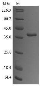 Tropomyosin alpha-1 chain (TPM1), rabbit, recombinant