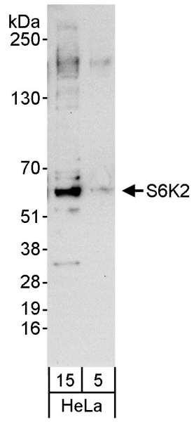 Anti-S6K2