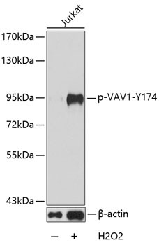 Anti-phospho-VAV1 (Tyr174)