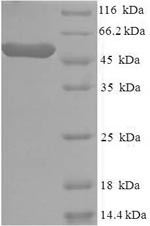 Casein kinase I isoform epsilon (CSNK1E), human, recombinant