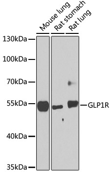 Anti-GLP1R