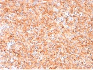 Anti-CD63 (Late Endosomes Marker), clone LAMP3/3315