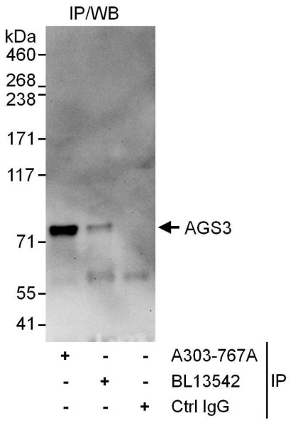 Anti-AGS3