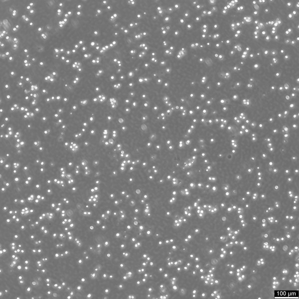 Kasumi-1 Cells