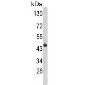 Anti-4-hydroxyphenylpyruvate dioxygenase / 4HPPD / HPD