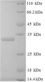 Placenta growth factor (PGF), human, recombinant