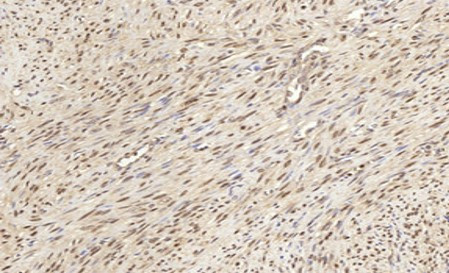 Anti-Hsp 70