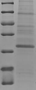 Protein S100-A7A (S100A7A), partial, human, recombinant