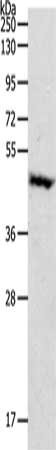 Anti-PDK4