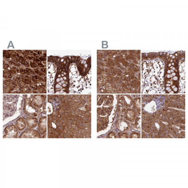 Anti-TCF25