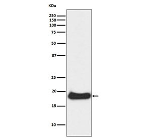 Anti-Claudin 1 / CLDN1, clone ABEH-3