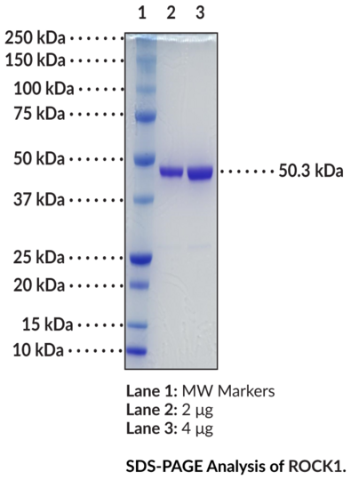 ROCK1 (human, recombinant)