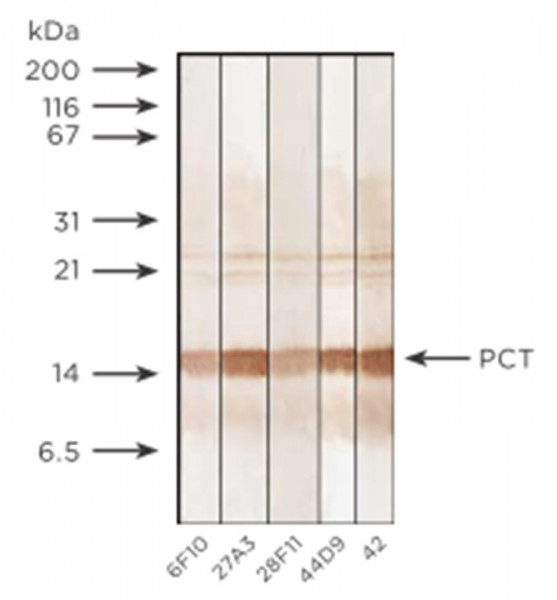 Anti-Procalcitonin, clone 6F10