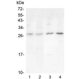 Anti-Oncostatin M / OSM