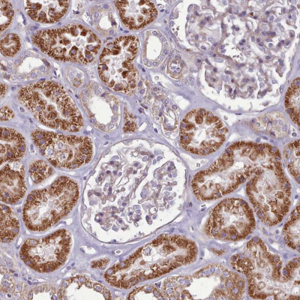 Anti-PAPD5